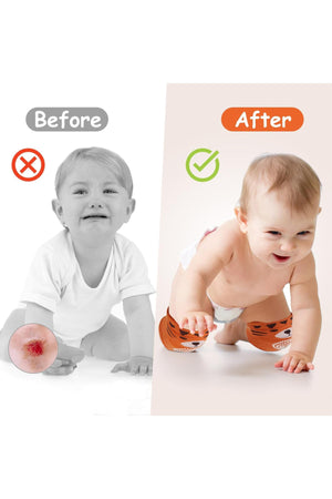 Star Babies Knee Pad - Pack of 2 - Blister Pack
